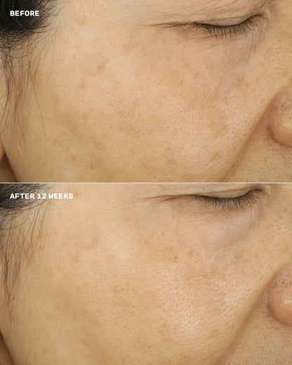 Even Better™ Brightening Essence Lotion - US 4765