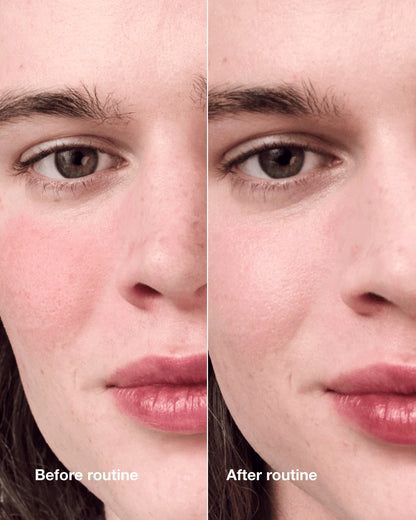 Redness Solutions Redness Regimen - US 0696